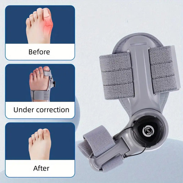 Bunion Corrector